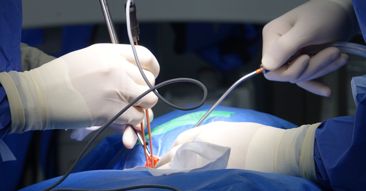 découvrez tout ce qu'il faut savoir sur l'épidurale : définition, déroulement, avantages, risques et conseils pour un accouchement serein. informations fiables et à jour.