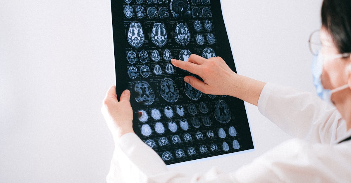 découvrez la maladie de basedow (graves), une affection auto-immune de la thyroïde provoquant hyperthyroïdie, symptômes, causes et traitements. informations et conseils pour mieux comprendre cette pathologie.