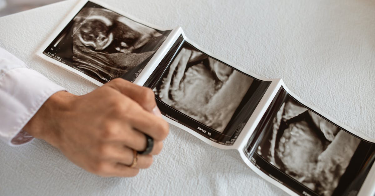 découvrez quand et comment utiliser un test de grossesse, les différents types disponibles, et comment interpréter les résultats pour confirmer une grossesse rapidement et en toute fiabilité.