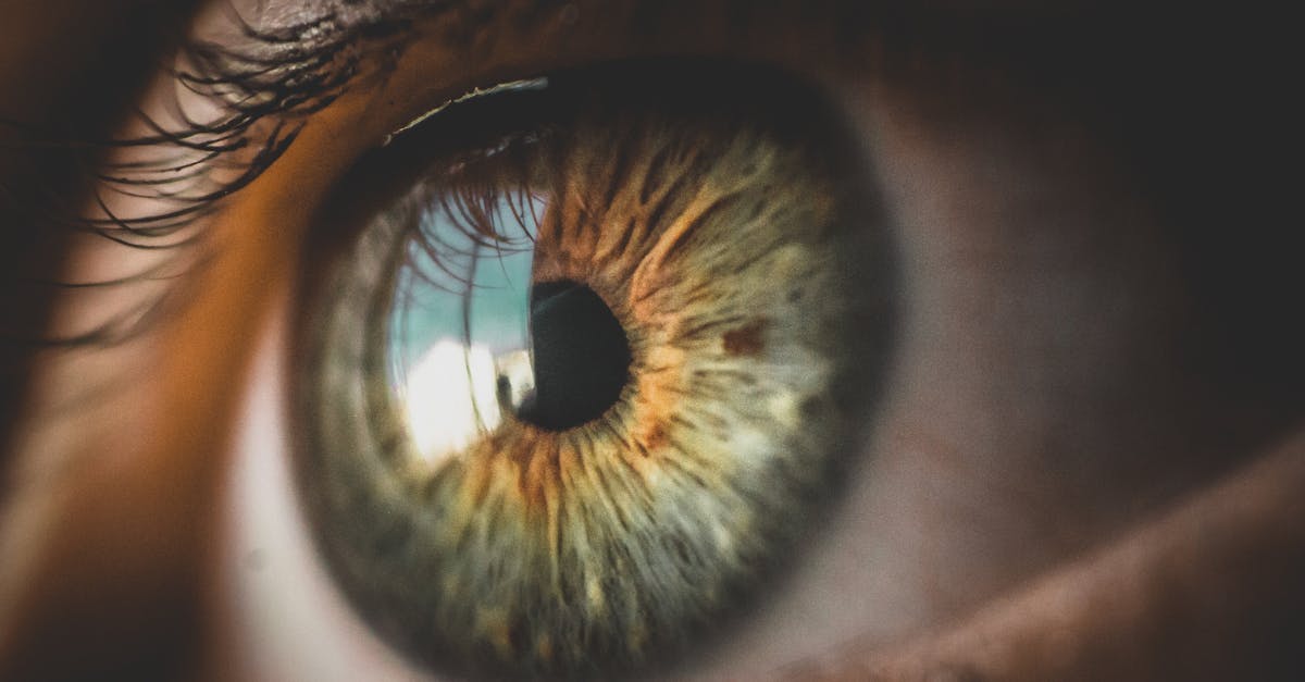 découvrez ce qu'est la dilatation rénale, ses causes, ses symptômes et les options de traitement disponibles pour mieux comprendre cette pathologie affectant les reins.