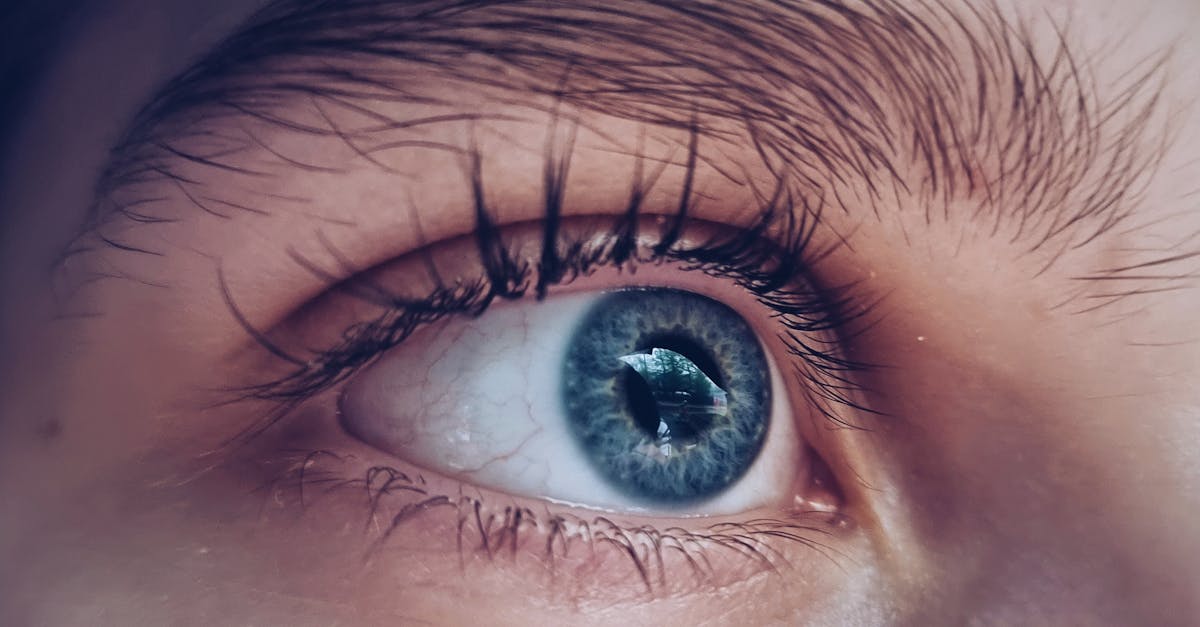 découvrez tout ce qu'il faut savoir sur la dilatation rénale : causes, symptômes, traitement et prévention pour une meilleure santé rénale.